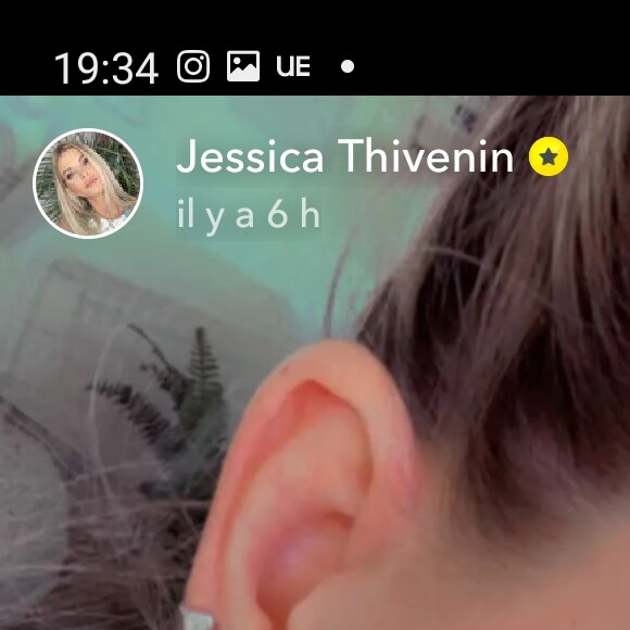 Jessica Thivenin opérée pour son trou de piercing, le 17 septembre 2021