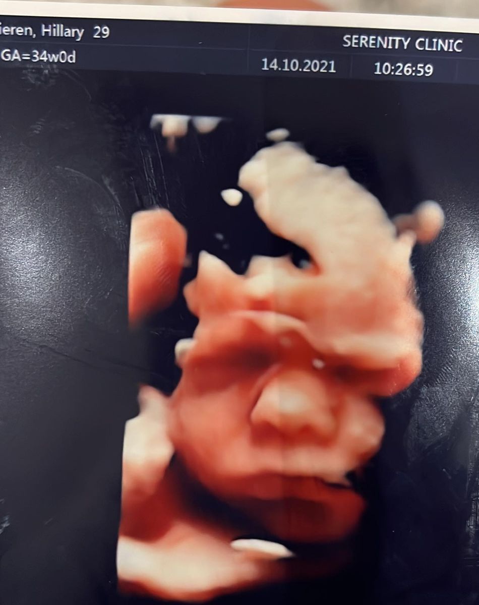Milo, le fils aîné d'Hillary Vanderosieren et Giovanni Bonamy, et son petit frère pas encore né sont de véritables sosies !