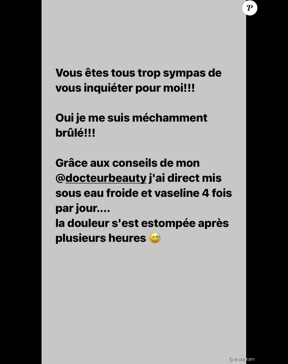 Laurie Cholewa s'est brûlée, elle partage une photo et donne des conseils