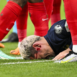 On peut voir qu'Antoine Griezmann a deux belles cicatrices et même un point de suture
Antoine Griezmann - Match de qualifications de l'Euro2024 "France - Grèce (1-0)" au stade de France, le 19 juin 2023.