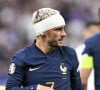 Antoine Griezmann montre sa grosse cicatrice
Antoine Griezmann - Match de qualifications de l'Euro 2024 "France - Grèce" au stade de France.