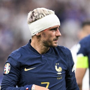 Antoine Griezmann montre sa grosse cicatrice
Antoine Griezmann - Match de qualifications de l'Euro 2024 "France - Grèce" au stade de France.