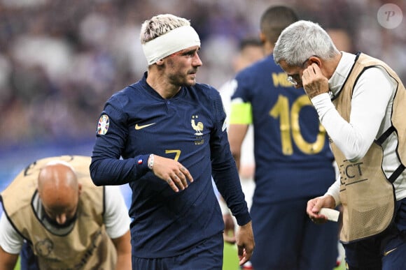 Antoine Griezmann montre sa grosse cicatrice
Antoine Griezmann - Match de qualifications de l'Euro 2024 "France - Grèce" au stade de France.