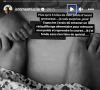 "Plus qu'à 5 kilos de mon poids d'avant grossesse... Je suis surprise", a-t-elle écrit.
Lucile (L'amour est dans le pré) évoque sa perdre de poids sur Instagram.