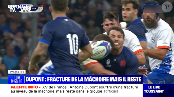 Images chocs et nouvelles d'Antoine Dupont après sa blessure contre la Namibie, "BFMTV".