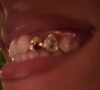 Et son sourire était un peu différent
Tina Kunakey a ajouté un bijou à ses dents pour un sourire éclatant. Photo publiée sur Instagram le 19 janvier 2024.