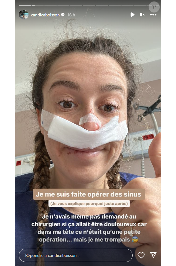 Elle a révélé sur Instagram qu'elle s'était fait opérer des sinus
Candice de "Koh-Lanta" s'est fait opérer des sinus