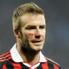 David Beckham, gravement blessé lors du match AC Milan- Chievo Vérone le 14 mars 2010.