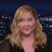 Amy Schumer, visage déformé : sa révélation sur le mal dont elle souffre