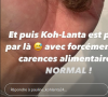 Elle a perdu beaucoup de cheveux
Pauline de "Koh-Lanta" dévoile qu'elle a perdu beaucoup de cheveux