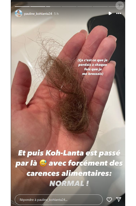 Elle a perdu beaucoup de cheveux
Pauline de "Koh-Lanta" dévoile qu'elle a perdu beaucoup de cheveux