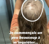 Elle avait même un trou sur la tête
Pauline de "Koh-Lanta" dévoile qu'elle a perdu beaucoup de cheveux