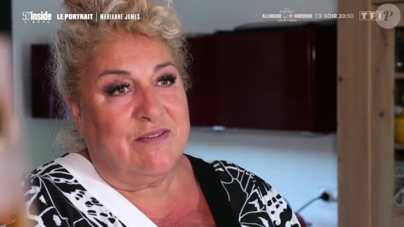 Marianne James a évoqué la possibilité d'avoir un jour recours à la chirurgie esthétique durant l'émission 50' inside sur TF1.