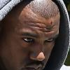 Kanye West avec une blessure au front suite à un petit accident qu'il a eu la veille Los Angeles, le 11 mai 2013.