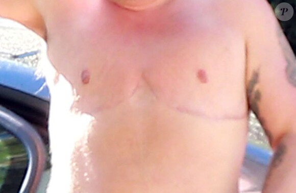 Exclusif - Chaz Bono, torse nu, rentre chez lui à Beverly Hills le 15 juillet 2013. On peut voir les cicatrices de son ablation des seins.