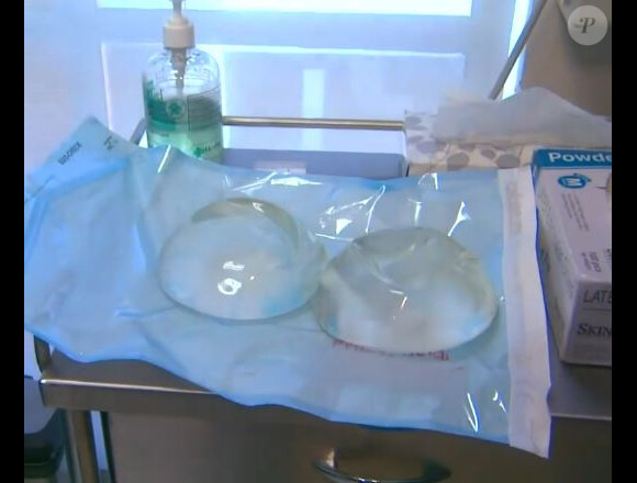 Voici les implants mammaires qu'Heidi Montag s'est fait retirer. Ils pèsent 1 kilo chacun et ont causé à l'ex-star de télé-réalité une série de problèmes de santé, notamment au niveau du dos.