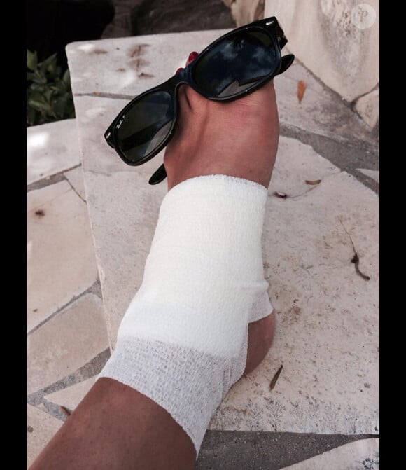 Karine Ferri s'est fait une légère blessure lors de ses vacances en Corse. Juin/Juillet 2014.