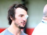 Florian Cazenave : Après la perte de son oeil, il va enfin rejouer au rugby