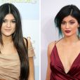  Kylie Jenner a bien chang&eacute;. La jeune femme en 2011 &agrave; gauche, en 2014 &agrave; droite, est la cible des rumeurs les plus folles concernant sa nouvelle apparence 