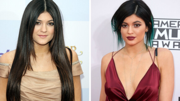 Kylie Jenner, 17 ans : Bouche, nez, silhouette... la soeur de Kim a bien changé