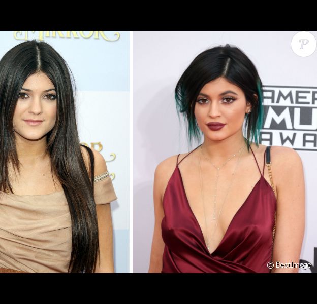 Kylie Jenner a bien chang&eacute;. La jeune femme en 2011 &agrave; gauche, en 2014 &agrave; droite, est la cible des rumeurs les plus folles concernant sa nouvelle apparence