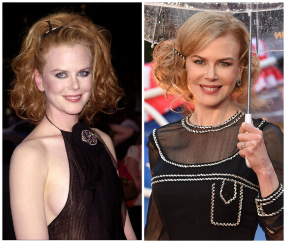Nicole Kidman en 2001 vs. Nicole Kidman en 2014.