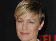 Chirurgie esthétique : Hollywood ou New York, les stars choisissent leur camp