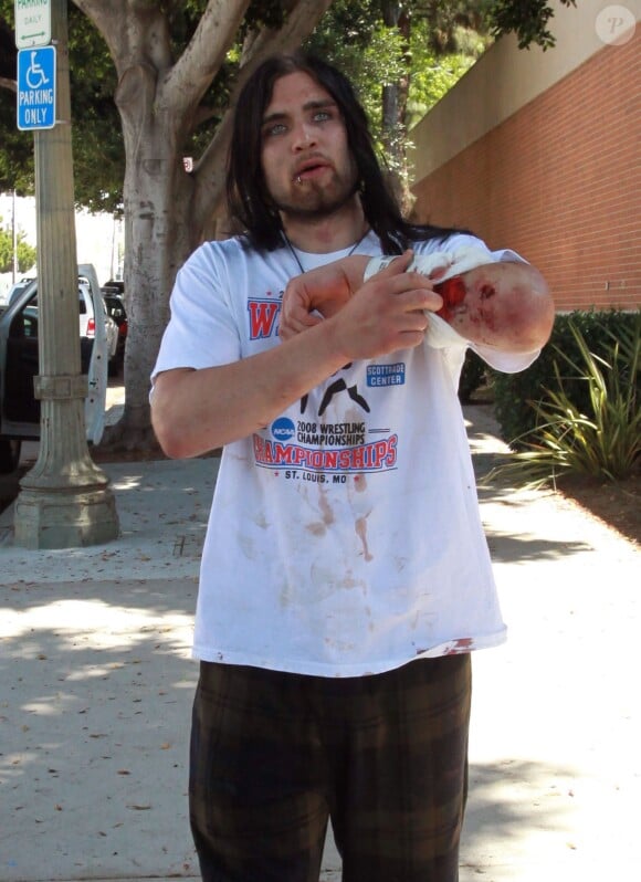 Weston Cage sort du poste de police le bras en sang après une bagarre avec sa femme le 4 juillet 2011 à Los Angeles.