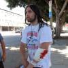 Weston Cage sort du poste de police le bras en sang après une bagarre avec sa femme le 4 juillet 2011 à Los Angeles.
