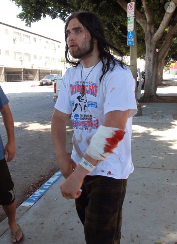 Weston Cage sort du poste de police le bras en sang après une bagarre avec sa femme le 4 juillet 2011 à Los Angeles.