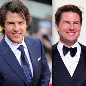 Tom Cruise en juillet 2015 et en février 2016 (Photomontage) : a-t-il cédé au Botox ?