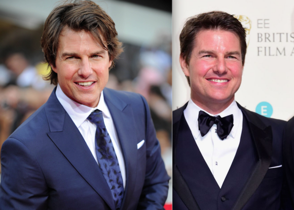 Tom Cruise en juillet 2015 et en février 2016 (Photomontage) : a-t-il cédé au Botox ?