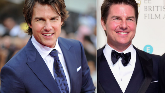 Tom Cruise visage bouffi : A-t-il cédé au Botox ?