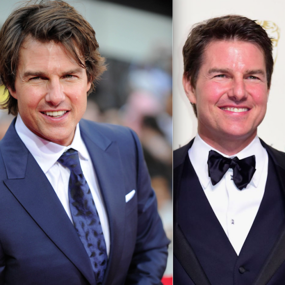 Tom Cruise en juillet 2015 et en février 2016 (Photomontage) : a-t-il cédé au Botox ?