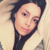 Alexia Mori juste après son opération du 24 mars 2016, avant les gonflements, sur Instagram.