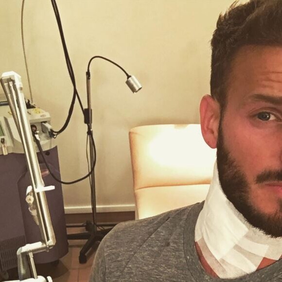 M. Pokora en pleine séance de détatouage : il fait part de sa souffrance sur son compte Instagram, le 2 avril 2016
