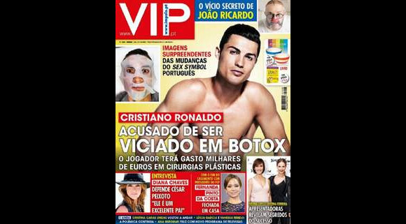 Couverture de VIP avec Cristiano Ronaldo accro au botox.