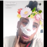 Eddy (Secret Story) en plein doute après sa rhinoplastie : "C'est un enfer"