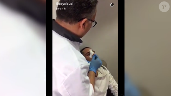 Eddy après son opération de chirurgie, Snapchat, mars 2017