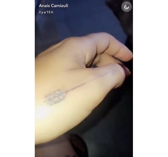 Anaïs Camizuli a décidé de se faire enlever des tatouages. Mars 2017.