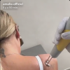 Amélie Neten, candidate révélée dans "Secret Story 4", filmée en pleine séance de dé-tatouage sur les réseaux sociaux.