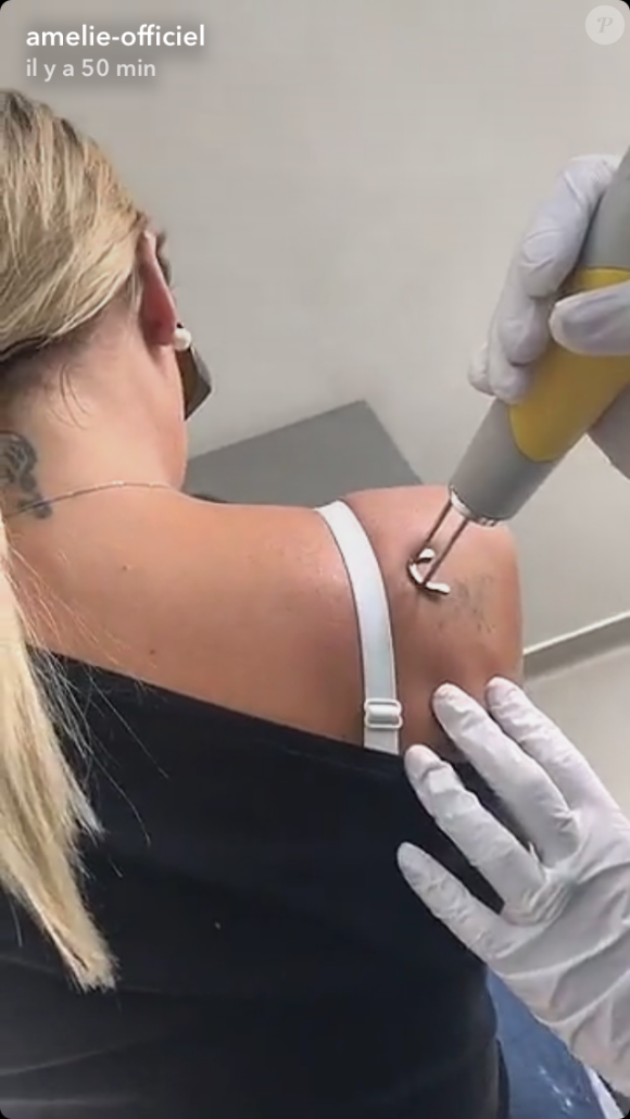 Amélie Neten, candidate révélée dans "Secret Story 4", filmée en pleine séance de dé-tatouage sur les réseaux sociaux.