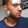 Morgan Ouatta victime d'une agression homophobe le 3 septembre 2017.