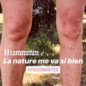 Laury Thilleman dévoile une photo de ses jambes sur Instagram - 19 juillet 2018