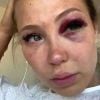 Andréane (Les Vacances des Anges 3) victime d'un accident de buggy sur le tournage - SnapChat, 4 septembre 2018