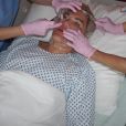 Rodrigo Alves alias "Human Ken Doll" lors d'une opération chirurgicale du visage au centre Medico Beauty &amp; IVF de Prague, République tchèque, le 3 mai 2018.