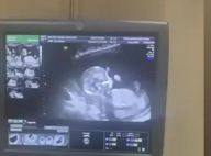 Nabilla enceinte, son échographie : première vidéo de son bébé qui bouge...