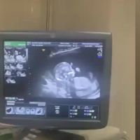Nabilla enceinte, son échographie : première vidéo de son bébé qui bouge...