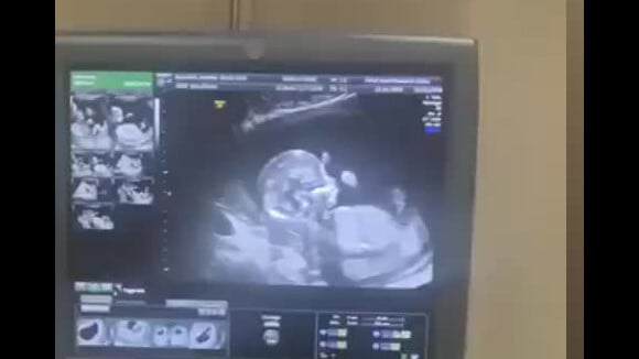 Nabilla dévoile son bébé qui bouge lors d'une première échographie, le 23 avril 2019.
