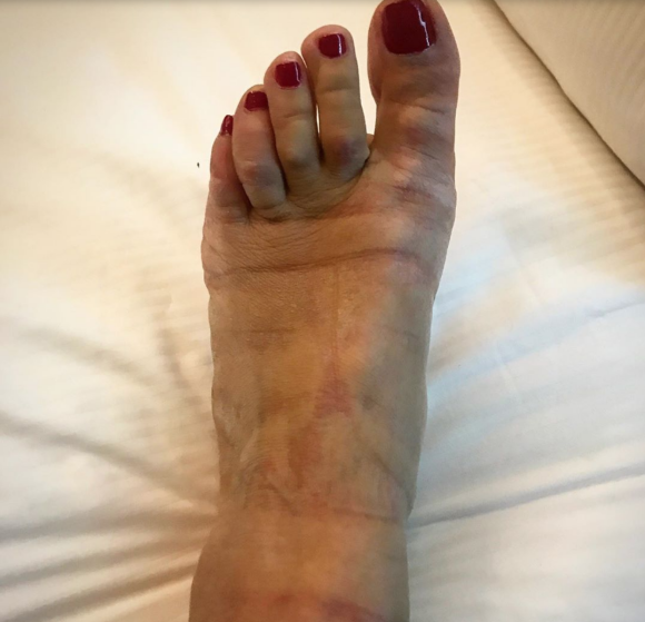 Romane Bohringer et son pied sur Instagram, le 16 mai 2019.